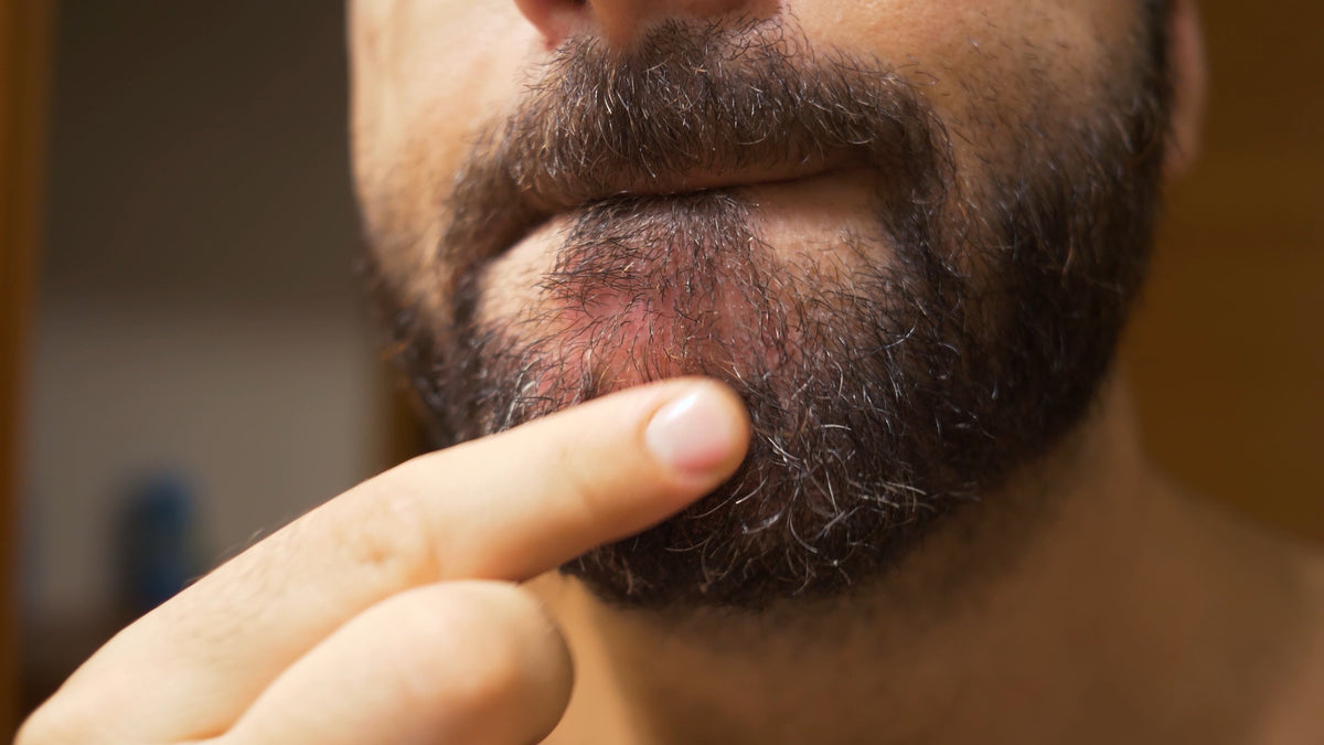How to Soothe an Itchy Beard (and Actually Enjoy Growing It)