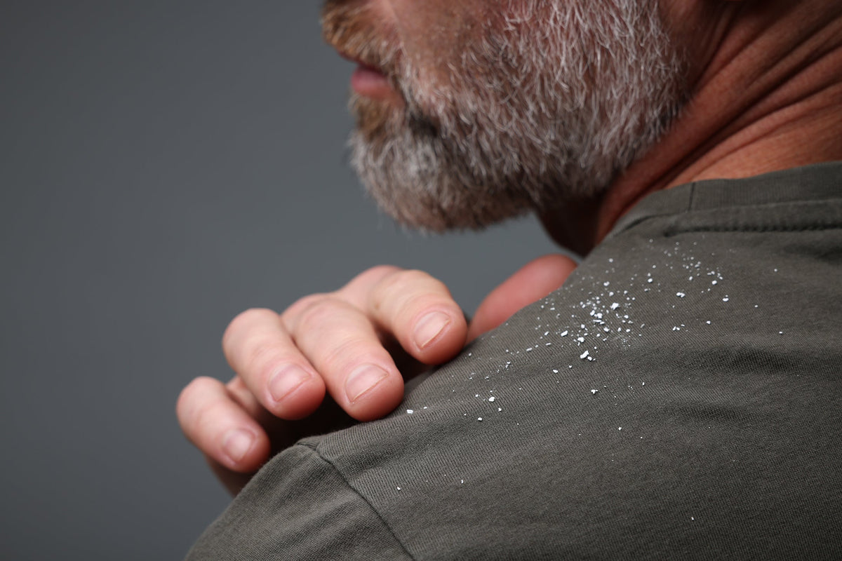 Why Does My Beard Feel Dry? Causes &amp; Solutions for a Healthier Beard